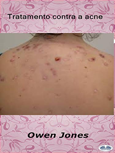 Livro PDF Tratamento contra a acne