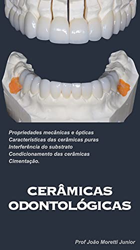 Livro PDF Cerâmicas Odontológicas: Propriedades mecânicas e ópticas, características das cerâmicas puras, interferência do substrato, condicionamento das cerâmicas, cimentação.