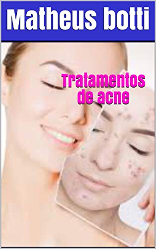 Livro PDF Tratamentos de acne