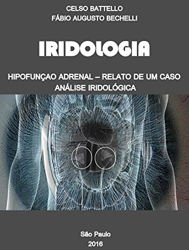 Capa do livro: Iridologia – Hipofunção Adrenal: Relato de um Caso – Análise Iridológica - Ler Online pdf