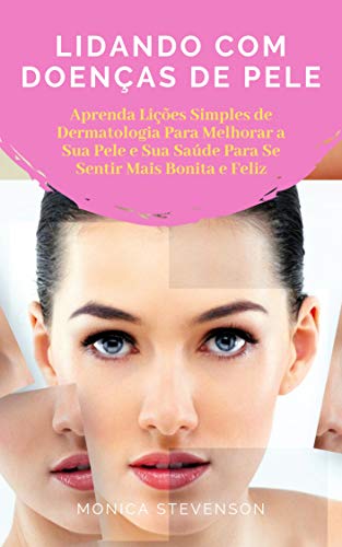 Livro PDF Lidando Com Doenças De Pele: Aprenda Lições Simples De Dermatologia Para Melhorar A Sua Pele, Lições Básicas de Estética Para a Sua Pele E Sua Saúde Para Se Sentir Mais Bonita E Feliz