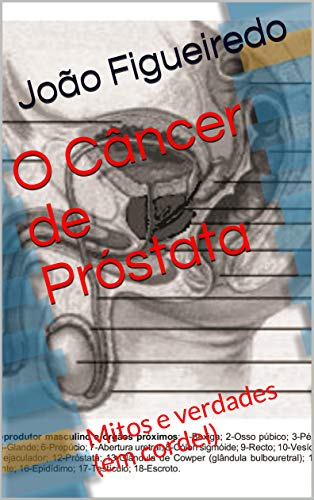 Capa do livro: O Câncer de Próstata: Mitos e verdades (em cordel) - Ler Online pdf
