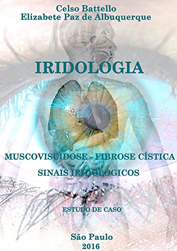 Capa do livro: Iridologia e Fibrose Cística; Mucoviscidose e Sinais Iridológicos - Ler Online pdf