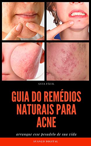 Livro PDF Guia dos Remédios Naturais Para Acne CRAVOS E ESPINHA
